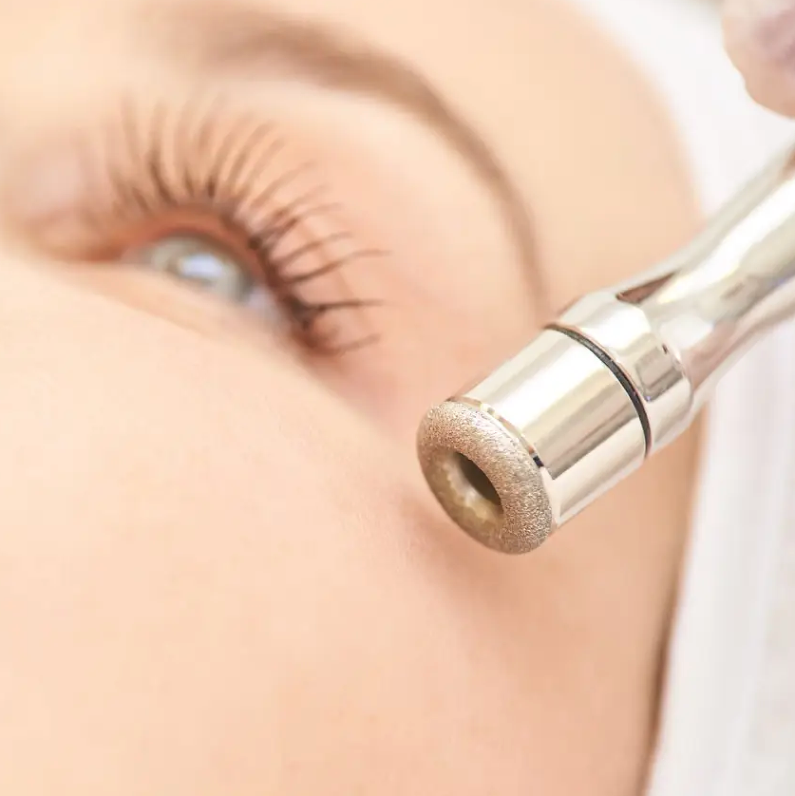 Diamond Microdermabrasion Treatment –