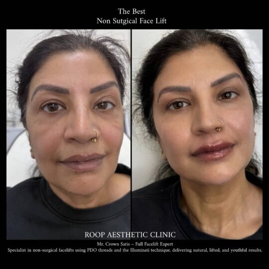 Full Face Transformation – Reveal Your Most Radiant Self