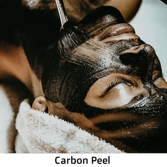 Carbon Laser Peel – The Ultimate Glow-Up