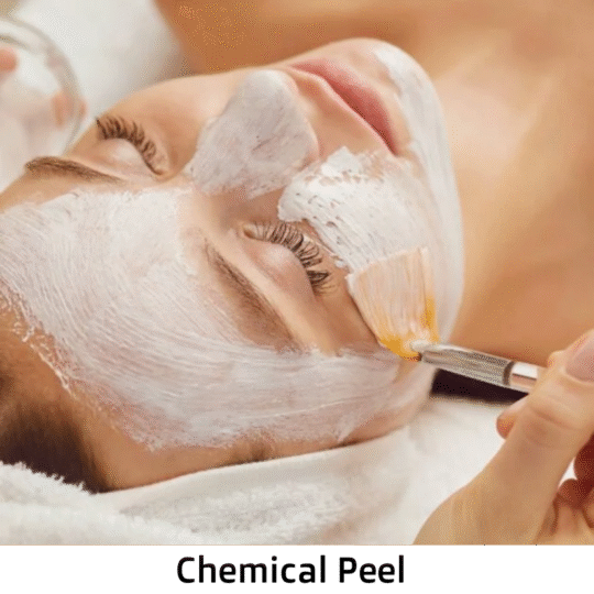 Transform Your Skin with Professional Peeling Therapy