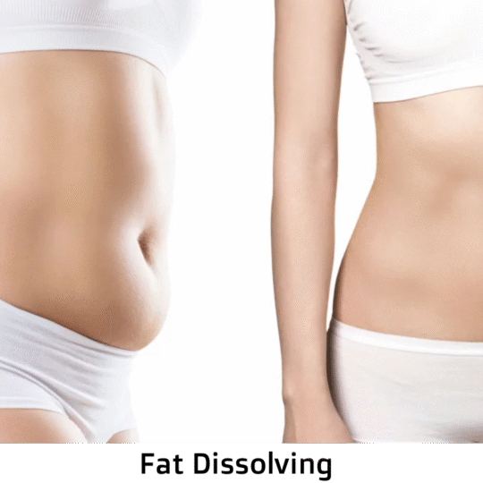 Targeted Fat Reduction with Fat Dissolving Injections